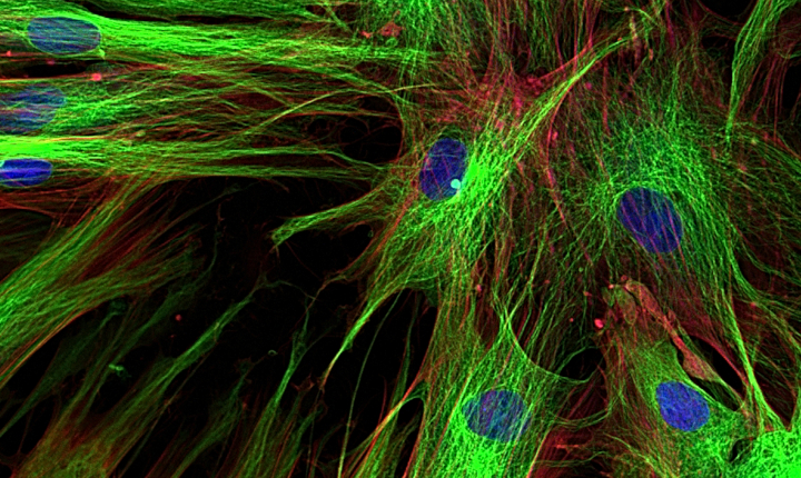 Magnified image of skin cells using fluorescence spectroscopy