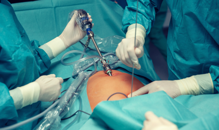 Team of surgeons using a medical endoscope on a patient in a hospital operating theater