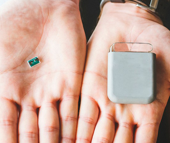 Boîtiers ultra-miniatures pour les dispositifs implantables