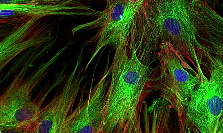 Magnified image of skin cells using fluorescence spectroscopy