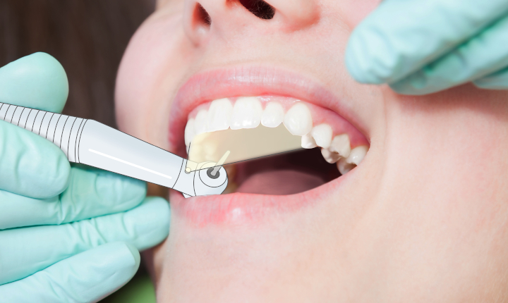 Female patient having a tooth examined by a dentist