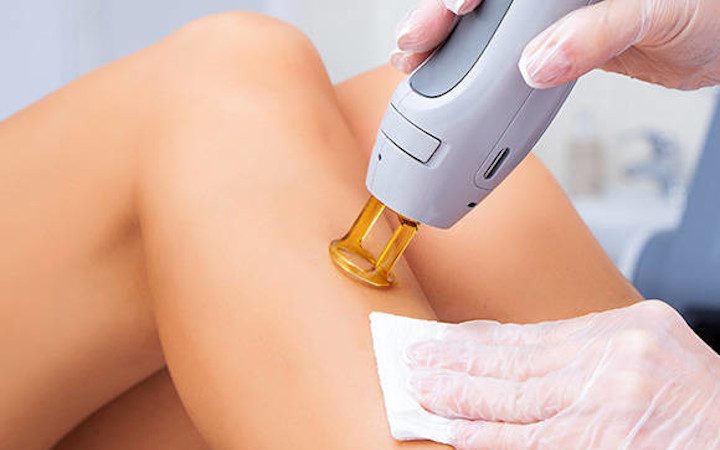 Cosmetic and medical laser surgery requires high quality light and image guides	