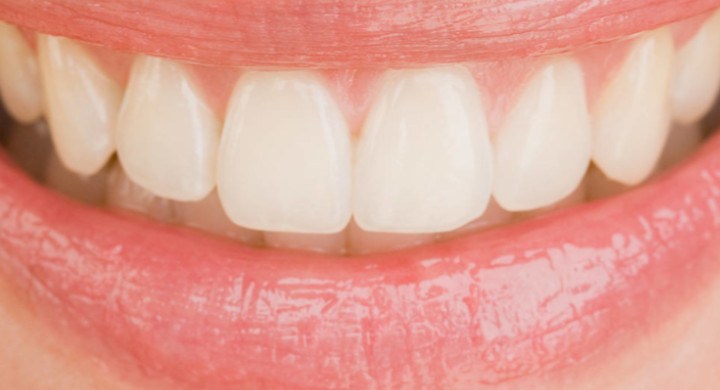A perfect smile with a little help from SCHOTT Close up of a female mouth smiling showing teeth