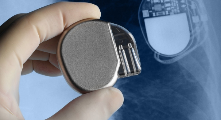 SCHOTT miniaturized glass packaging for implant electronics and batteries Hand holding a medical implant in front of an x-ray image