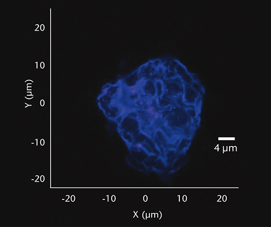 Particle analysis