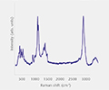 Particle analysis