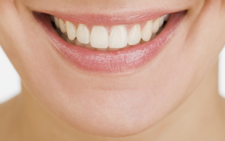 Close up of a female mouth smiling showing teeth 