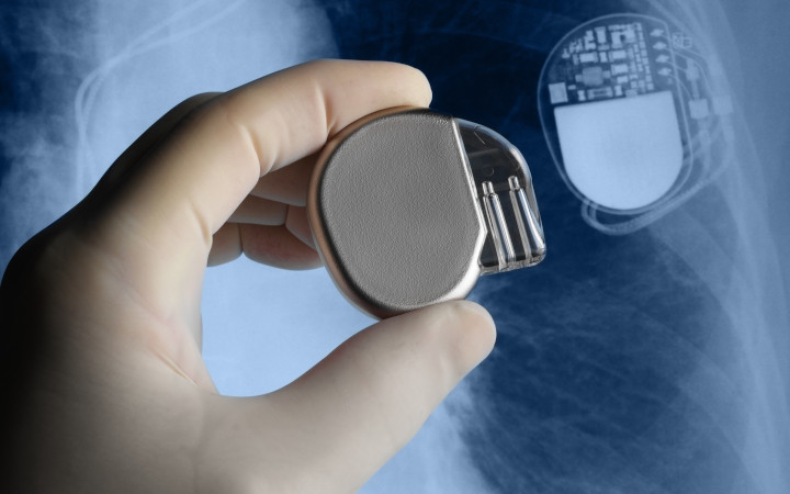 Hand holding a medical implant in front of an x-ray image