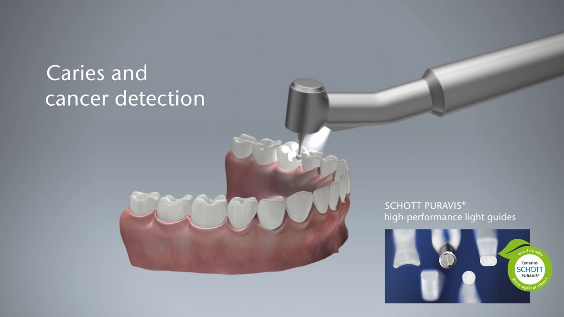 Click to discover how SCHOTT Light Guide Rods enable the design of ergonomic handpieces and turbines