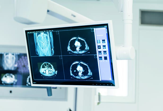 Monitor in a hospital showing four x-ray images